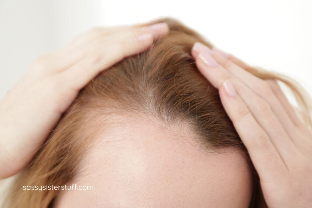 closeup of a woman showing her changing hairline.
