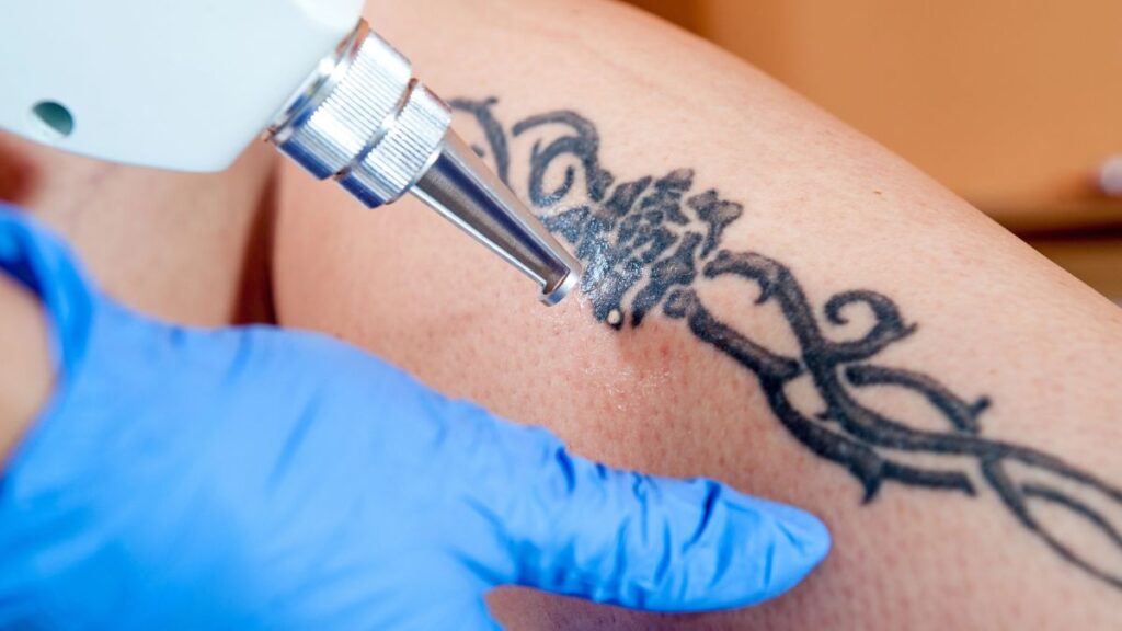 tattoo