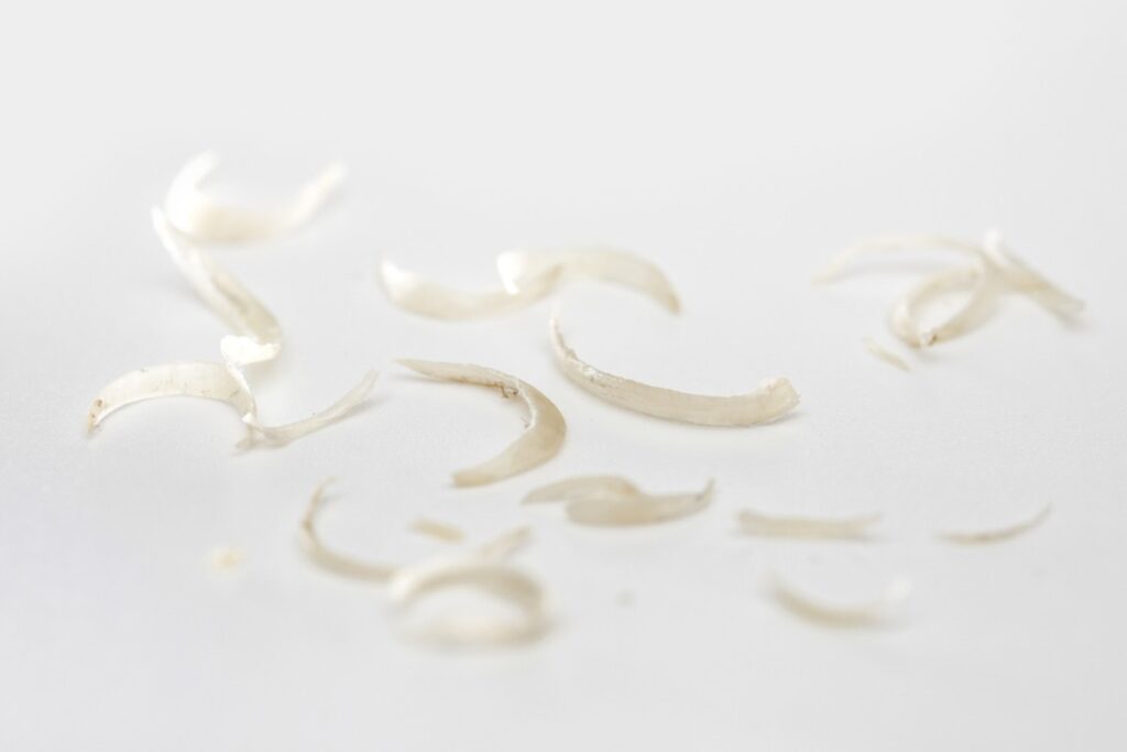 Fingernail clippings saved over years